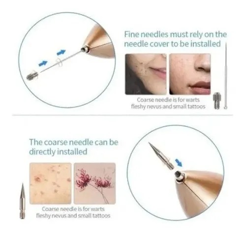 Quita Verrugas Manchas Y Acné